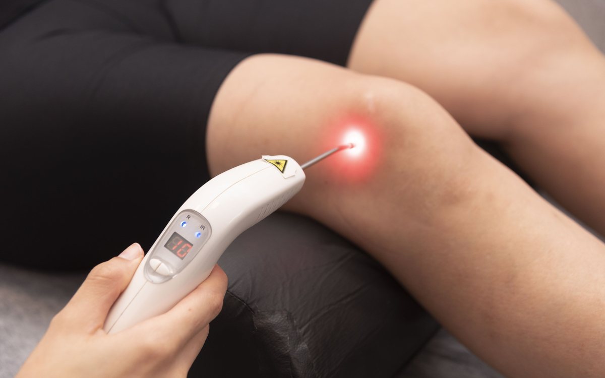 Aplicação de laser terapêutico no joelho durante sessão de fisioterapia